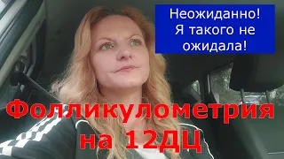 Овуляция/Фолликулометрия на12ДЦ