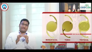 Lens / IOL Options for Cataract Surgery-Dr Madhu Uddaraju Telugu-Dr Shanthi RamanaRaju'sVisionTree