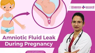 Amniotic Fluid Leak During Pregnancy | प्रेग्नेंसी के दौरान एमनियोटिक फ्लूइड लीक होना | Dr. Sabita