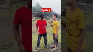 Eye Flu😎😜😀😂 #sumanroy143 #comedy #comedyvideo #funny #funnyvideo #trending #tiktok #viral #shorts