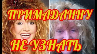 🔶АЛЛА ПУГАЧЕВА О ЛИЧНОМ 🔶ПЛАСТИЧЕСКИЕ ОПЕРАЦИИ 🔶