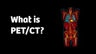 What is PET/CT and how does it work?