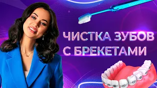 Как чистить зубы с брекетами // Виктория Седельникова
