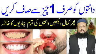 Dant Saaf Karne Ka Tarika | Teeth Saaf Karne Ka Tarika | Teeth Whitening | Hakeem Mehmood Tohidee