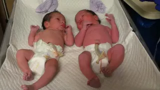 Welcome my twin babies delivery(3)