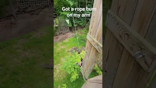 rope burn hurt