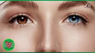 Heterocromía de iris | ¿Por qué tengo OJOS DE COLOR? | ¿El color de los ojos es por GENÉTICA?