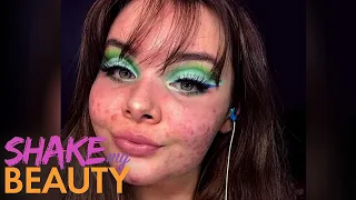 I'm Not Hiding My Acne, I'm Embracing It | Shake My Beauty