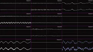 Pokémon B2W2 "Battle! PWT Finals!" - Oscilloscope Deconstruction