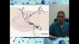 Dr. Cesar Benitez Pozo Cirujano Cardiotorácico