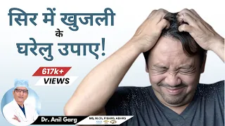 सिर में खुजली - 5 बड़े कारण | Itchy Scalp Problem | Treatment | Head Itches Even After Washing Hair