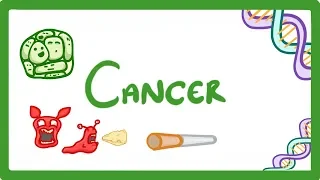 GCSE Biology - What is Cancer? 'Benign' and 'Malignant' Tumours Explained  #43