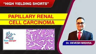 High Yielding Shorts-81 (#HYS-81):Papillary Renal cell carcinoma by Dr Devesh Mishra