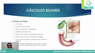 Cálculos a la Vesícula Biliar. ¿Se pueden eliminar sin cirugía?