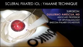 YAMANE TECHNIQUE - Dr. GUILLERMO AMESCUA - BIONIKO MODELS