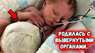 Малышка родилась с вывернутыми наружу органами, но ее мама решила не сдаваться!