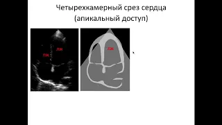 Ультразвуковая анатомия сердца