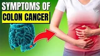 10 Critical Colon Cancer Symptoms You Should Never Ignore