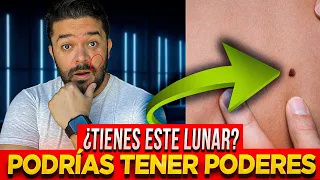 La MAYORIA tienen esta MARCA y no lo APROVECHAN - El SIGNIFICADO OCULTO de tus LUNARES