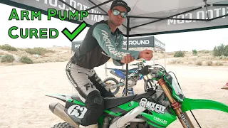 How To Get Rid Of Arm Pump On A Dirt Bike