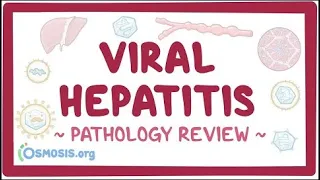 Viral hepatitis: Pathology Review