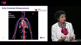 EACVI free webinar: Contrast echocardiography in daily routine practice