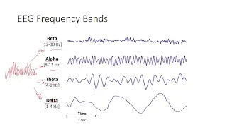 EEG Signal Processing