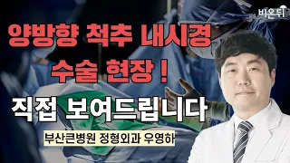 양방향 척추 내시경 수술 현장 !  직접 보여드립니다 / 부산큰병원 정형외과 우영하