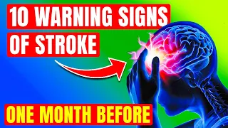 Stroke Warning Signs: Know These 10 Signs to Save a Life (They Appear EARLY!)