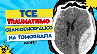 TRAUMATISMO CRANIOENCEFÁLICO / TCE - Tomografia de Crânio no Trauma Parte II