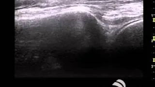 SonoSim Ultrasound Video Challenge - Ankle