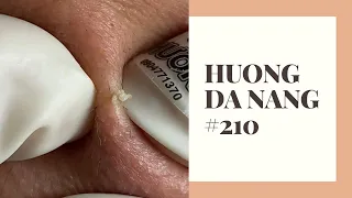 #210 | Huong Da Nang