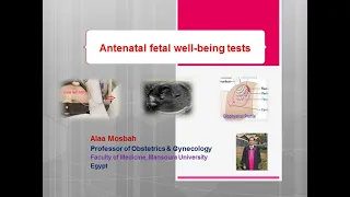 Antenatal fetal well being tests