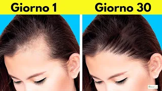 Come FERMARE la CADUTA dei CAPELLI nell'UOMO e nella DONNA