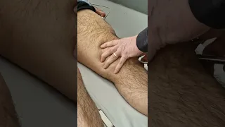 Manipulation Under Anesthesia for Knees