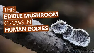 This Edible Mushroom Grows In Human Bodies