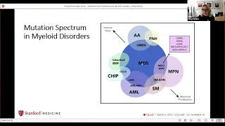 Pediatric Acute Myeloid Leukemia: A Clinical Challenge