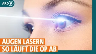Augen lasern: Methoden, Chancen und Risiken der OP | ARD GESUND