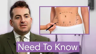 Liposuction: Everything You Need to Know