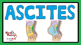 ASCITES - Serum Ascites Albumin Gradient (SAAG) | Ascites Pathophysiology | Ascites Causes