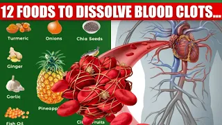 Top 12  Everyday Foods That Naturally Dissolve Blood Clots | How to cook