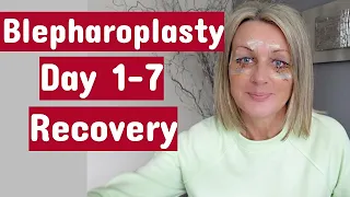 My Blepharoplasty(Upper&Lower) / Day 1-7 Recovery