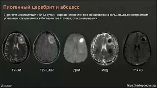 Вебинар МРО РОРР: Нейроинфекции много лиц одного процесса