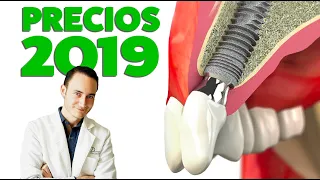 Implantes Dentales PRECIOS 2019 ¿Subirán de precio este año?
