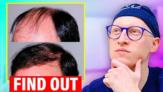 Is Hair Transplant For YOU?