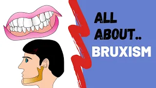 All About Bruxism