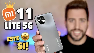 Xiaomi 11 Lite 5G ¿Mejor Gama Media del año? | Review Honesta