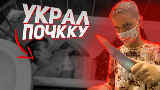 УКРАЛ ПОЧКУ У ДРУГА / ПРАНК