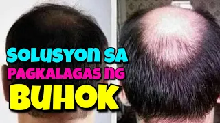 PAGKALAGAS NG BUHOK| SOLUSYON SA PAGKAPANOT