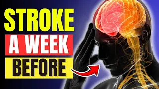 10 Warning Signs of Stroke A Week Before It Happens | Healthiera